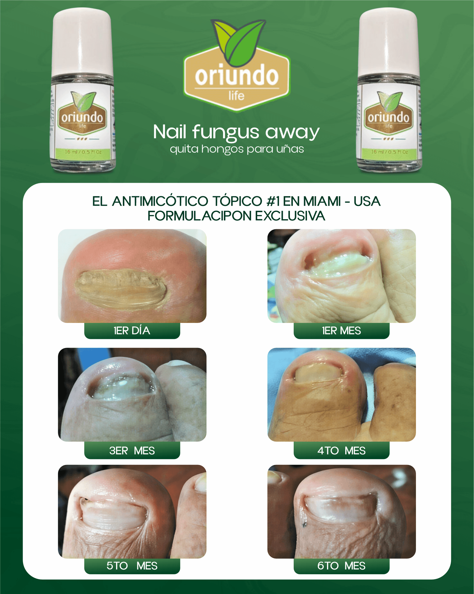 Progresión real del tratamiento: 1er día hasta 6 meses